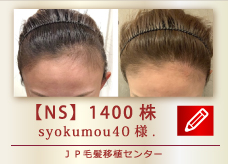 【NS】　1400株